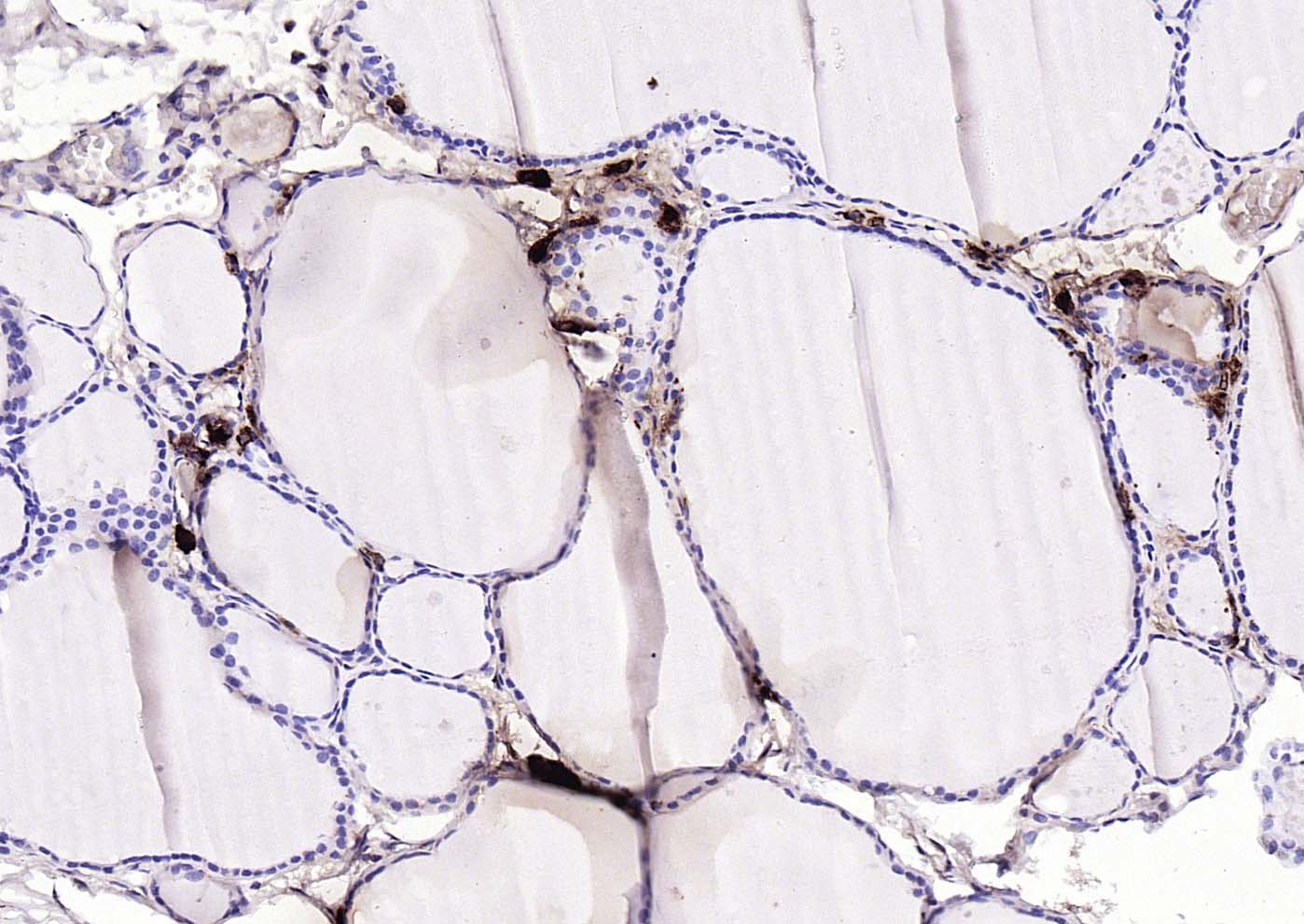 Procalcitonin (PCT) Mouse mAb(