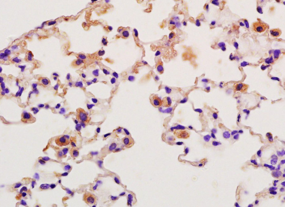 SFTPA1 Rabbit pAb(bs-0770R)-50