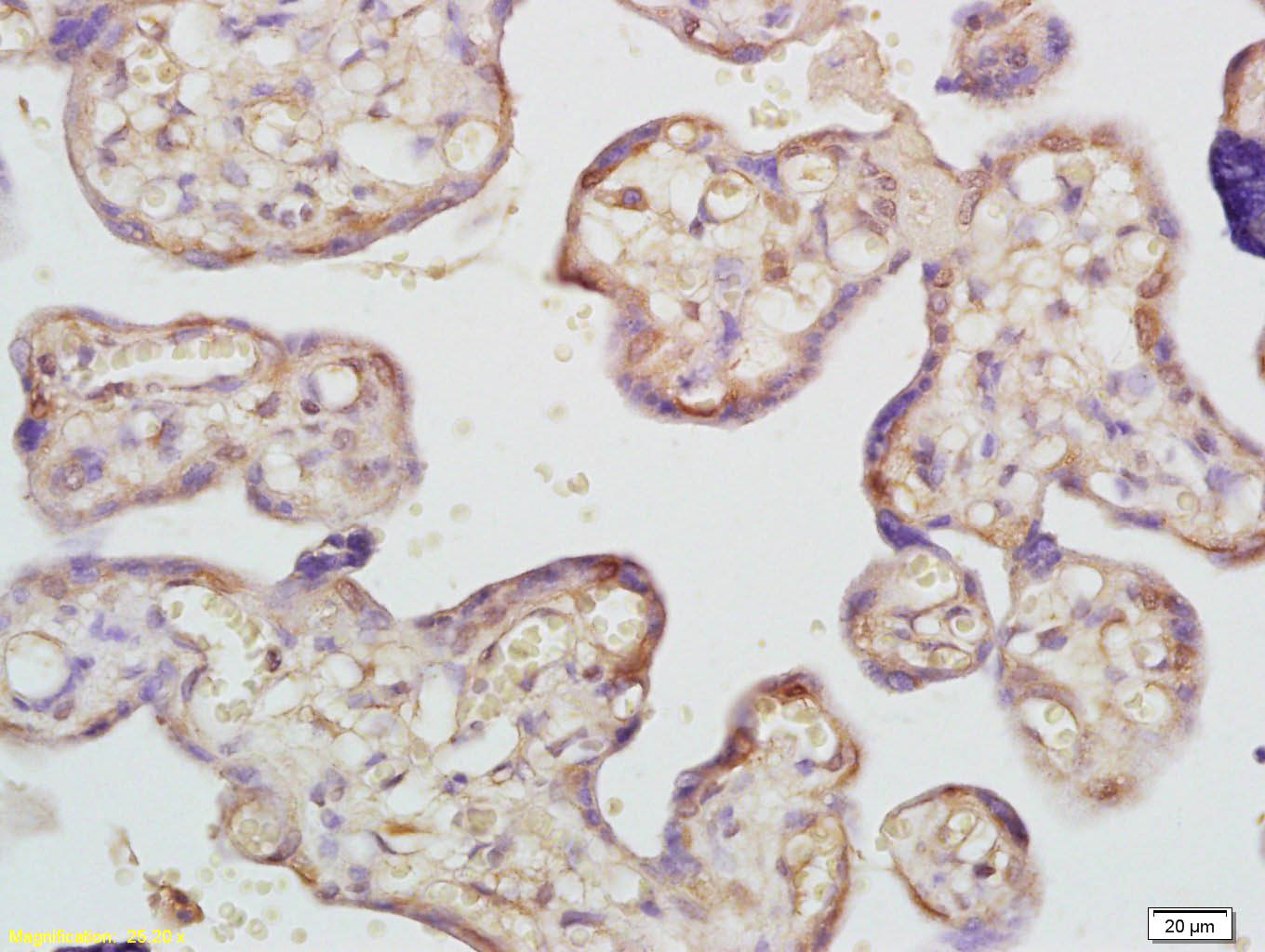 ADAMTS7 Rabbit pAb(bs-0433R)-5