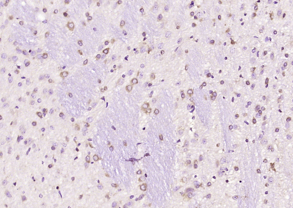 FRMPD2 Rabbit pAb(bs-9038R)-50