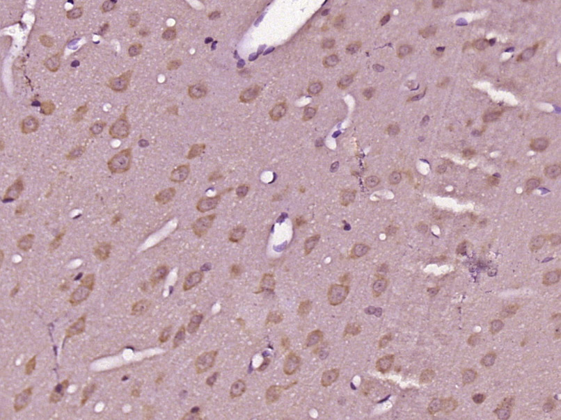 GPR89A Rabbit pAb(bs-15391R)-5