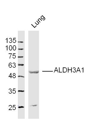 ALDH3A1 Rabbit pAb(bs-15496R)-