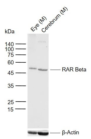 RARB Rabbit pAb(bs-0516R)-50ul