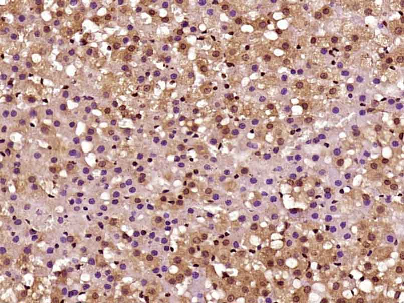 CARM1 Rabbit pAb(bs-4098R)-50u