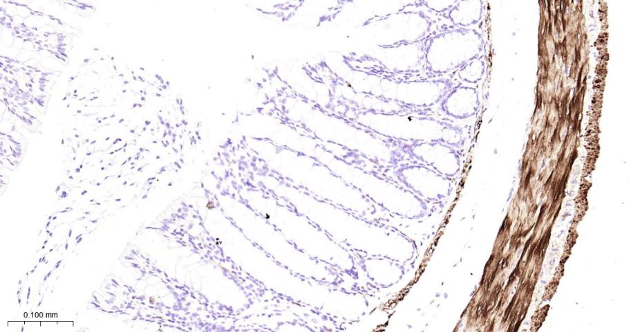 Hsp27 Recombinant Rabbit mAb(b