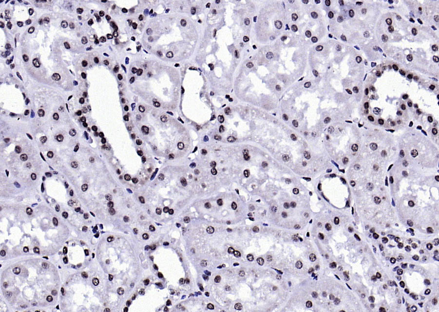 phospho-FGFR1 (Tyr307) Rabbit 