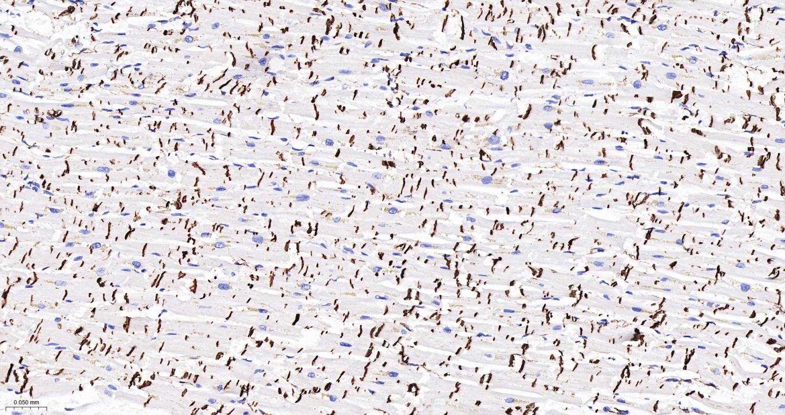 N-cadherin Mouse mAb(bsm-34125