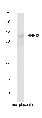 RNF12 Rabbit pAb(bs-9177R)-50u