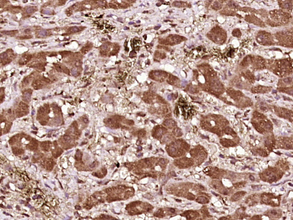 phospho-BAD (Ser99) Rabbit pAb