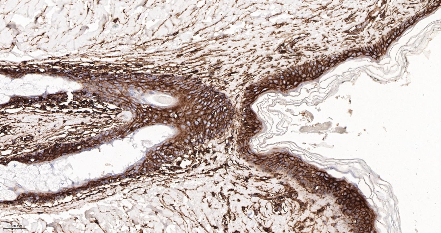 CD44 Recombinant Rabbit mAb(bs