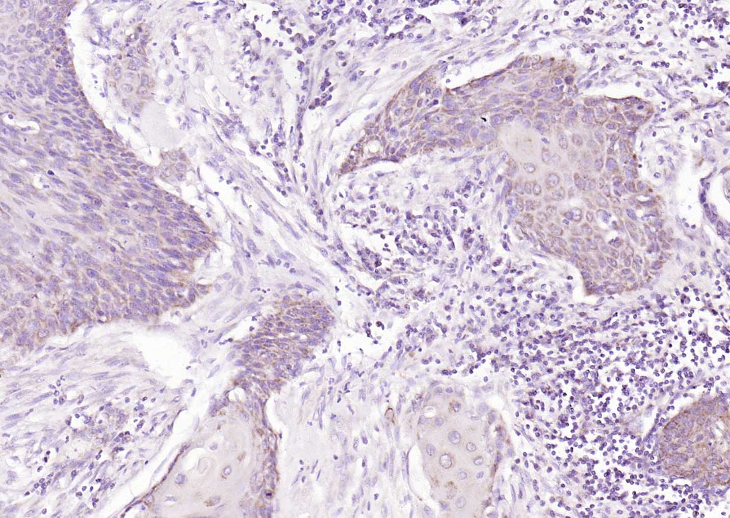 MAPK4 Rabbit pAb(bs-4131R)-50u