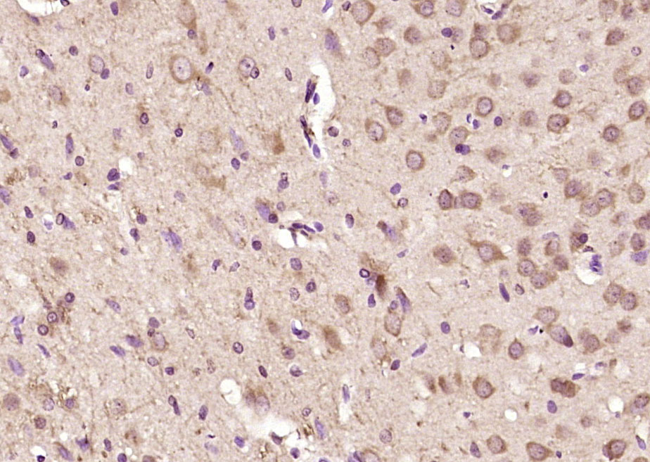 FBXO31 Rabbit pAb(bs-6006R)-50