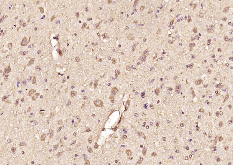 TRAX Rabbit pAb(bs-16708R)-50u