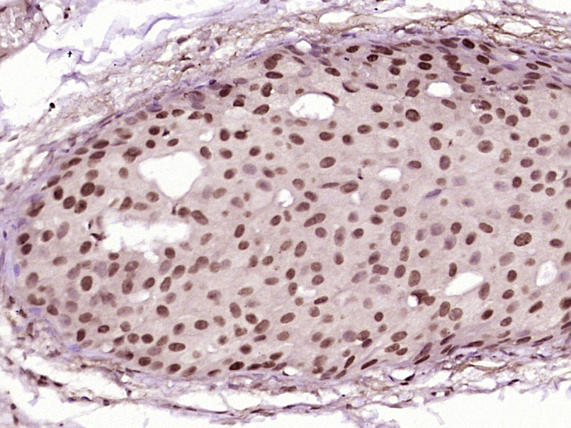 SMYD3 Rabbit pAb(bs-5974R)-50u