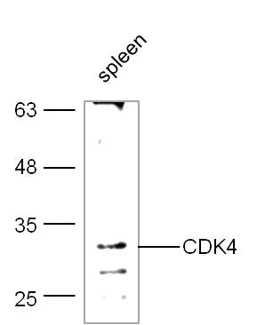 CDK4 Rabbit pAb(bs-0633R)-50ul