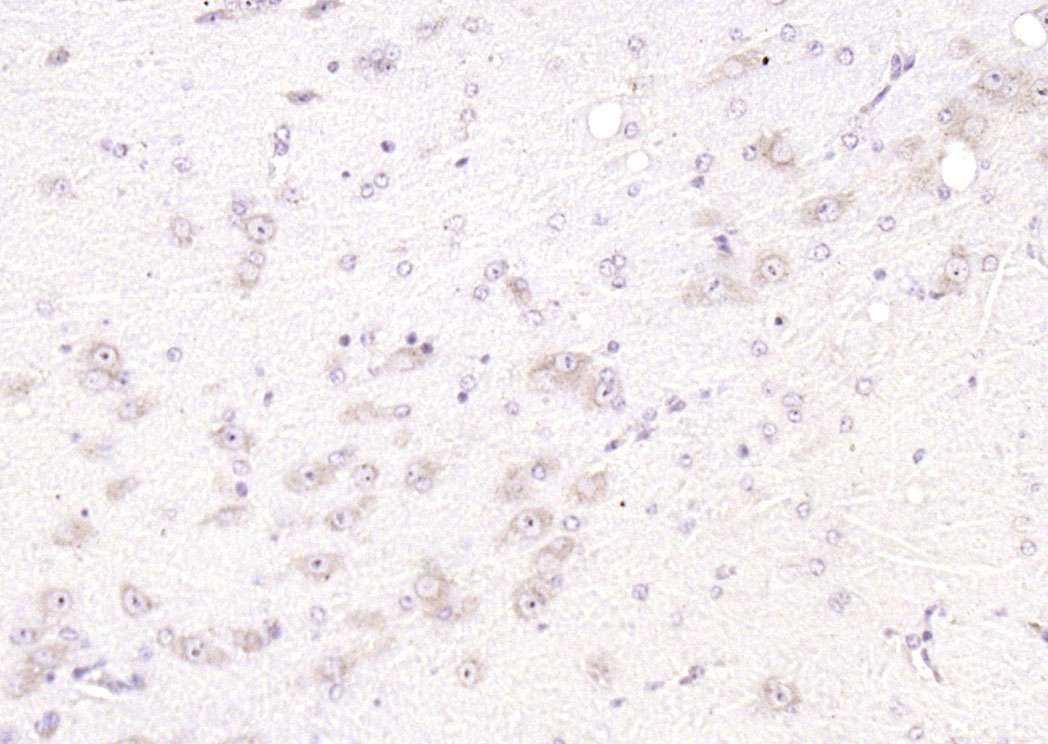 SGK1 Rabbit pAb(bs-4904R)-50ul