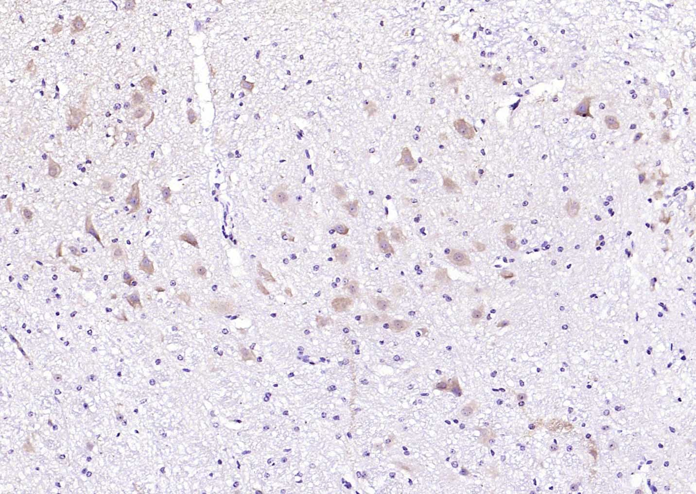 MAPK4 Rabbit pAb(bs-4131R)-50u