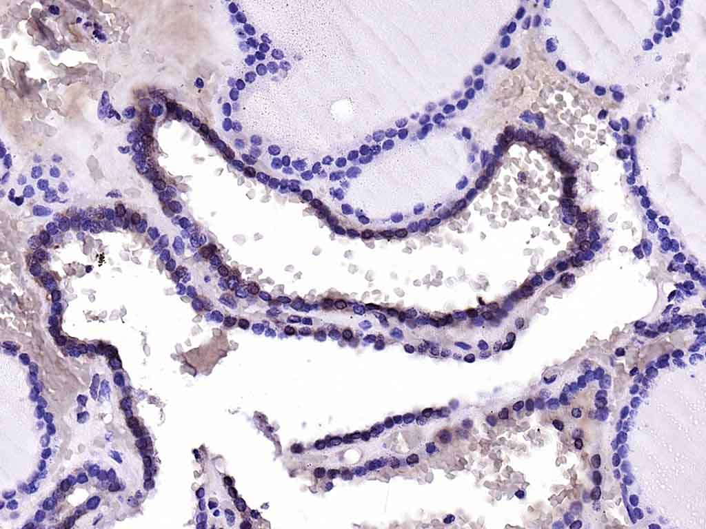 Cux2 Rabbit pAb(bs-11832R)-50u