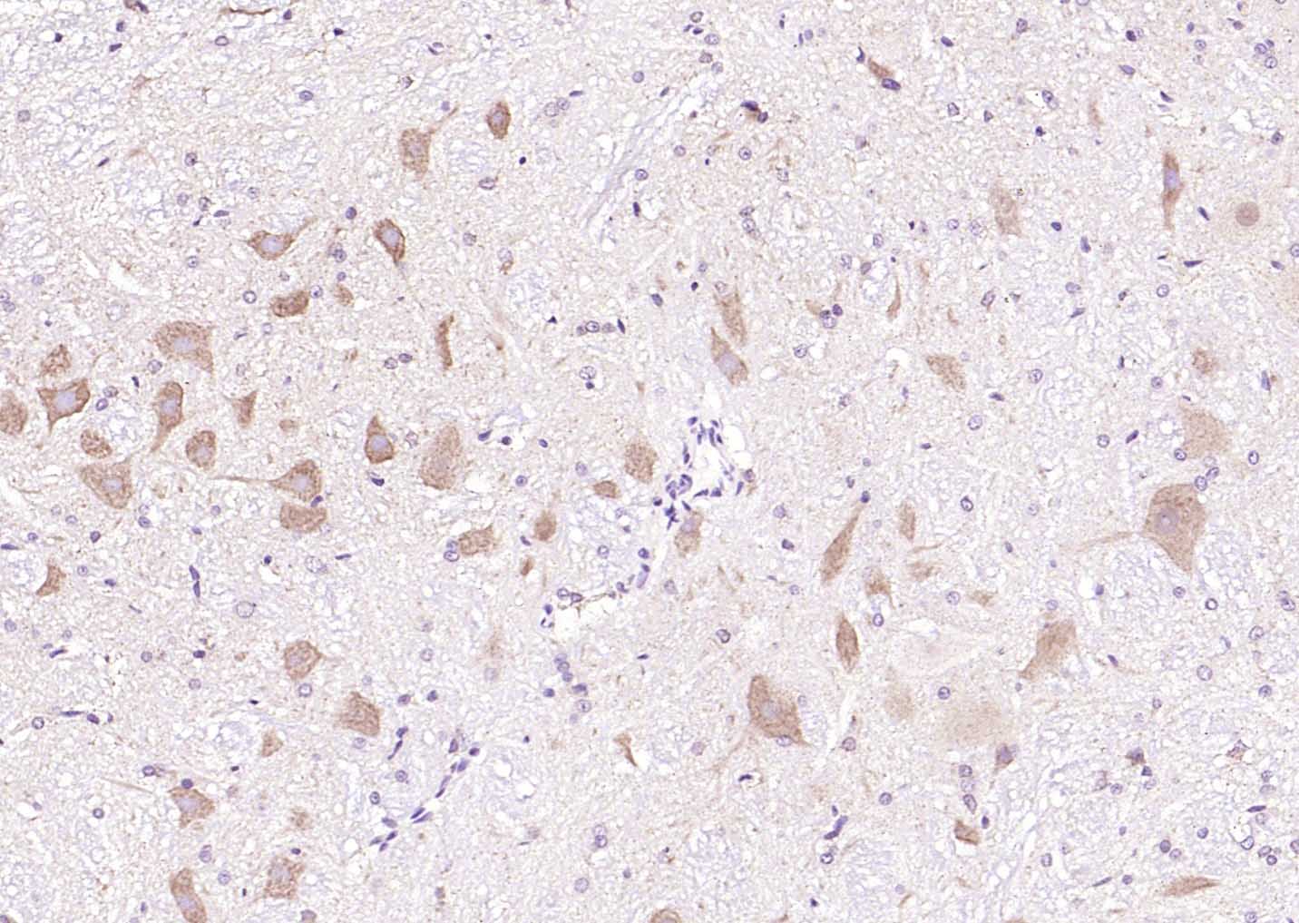 MAPK4 Rabbit pAb(bs-4131R)-50u