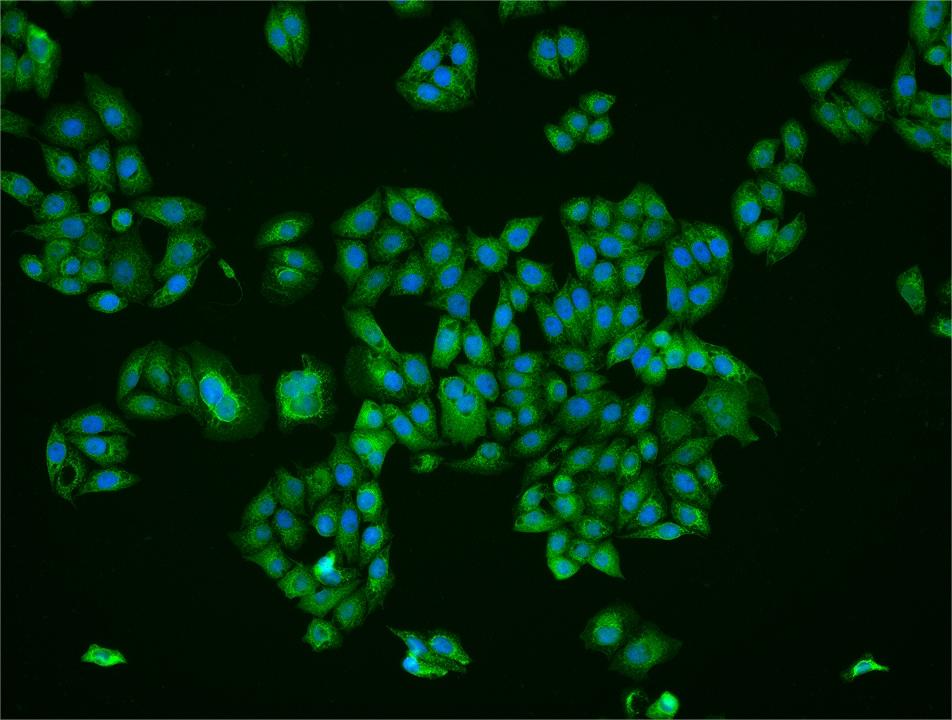 FBP1 Rabbit pAb(bs-20431R)-50u