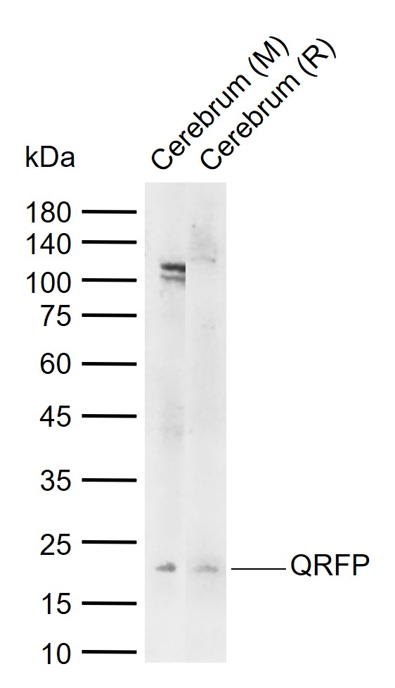 QRFP Rabbit pAb(bs-11534R)-50u
