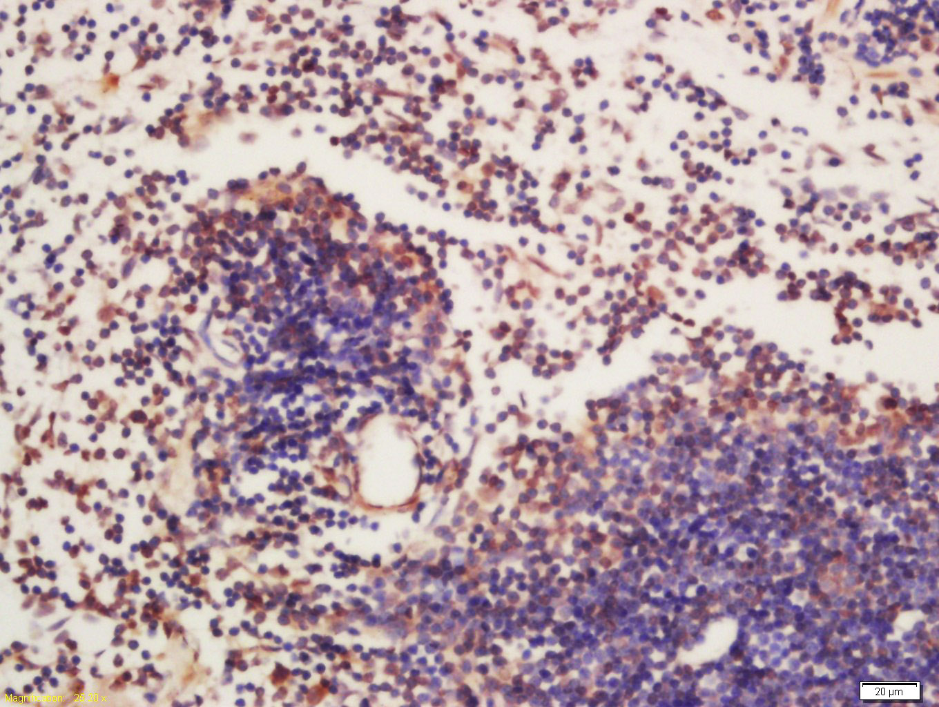 phospho-BTK (Tyr223) Rabbit pA