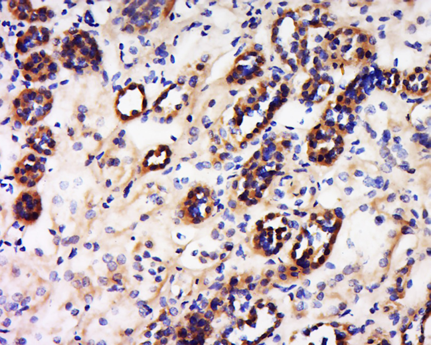 phospho-VEGF receptor 2 (Tyr10