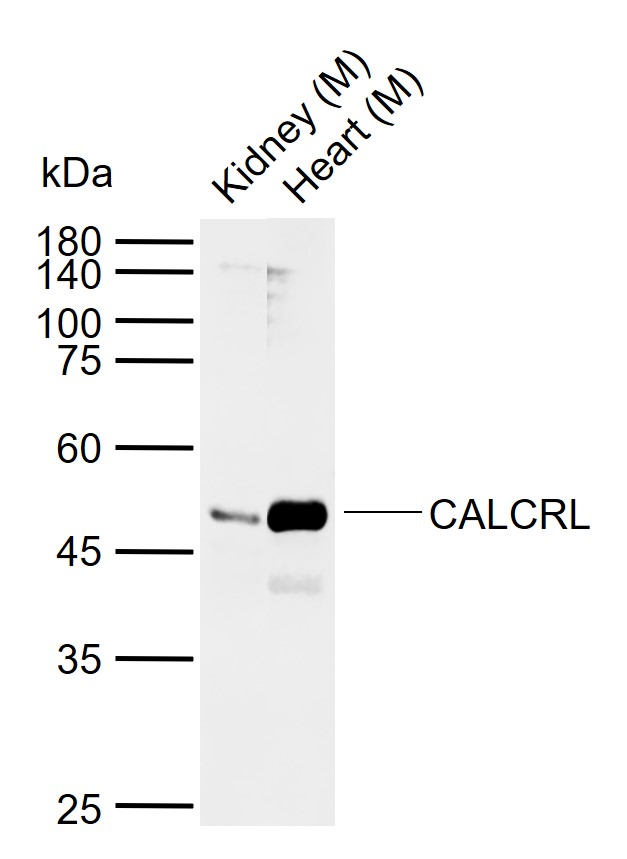 CALCRL Rabbit pAb(bs-1860R)-50