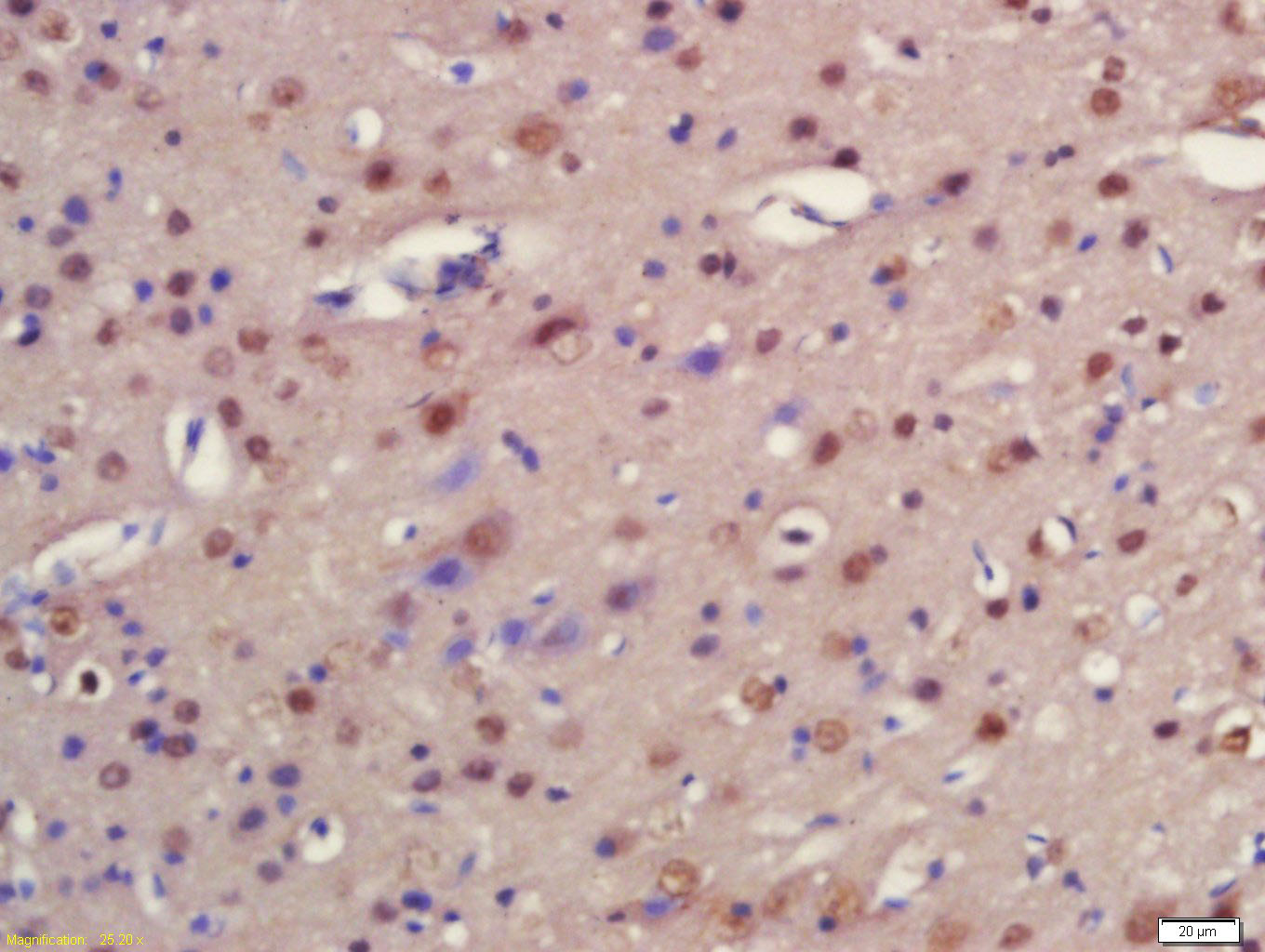 FNIP1 Rabbit pAb(bs-13193R)-50