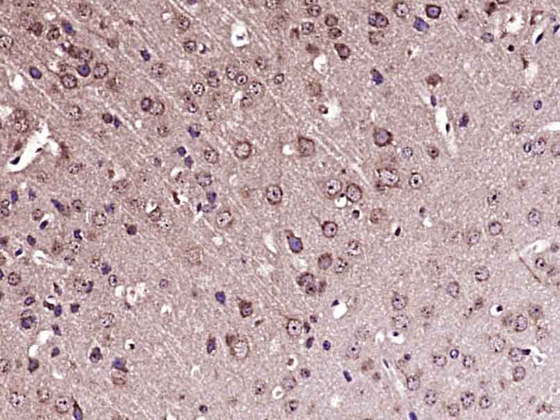 Tubb3 Rabbit pAb(bs-2670R)-50u