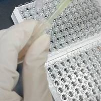 免疫杀伤效率定量-IFN-γ检测（ELISA）