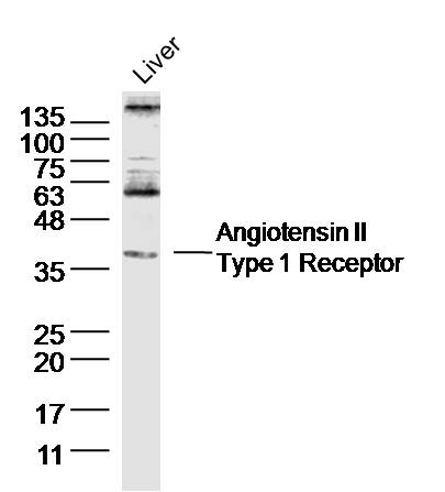 Angiotensin II Type 1 Receptor
