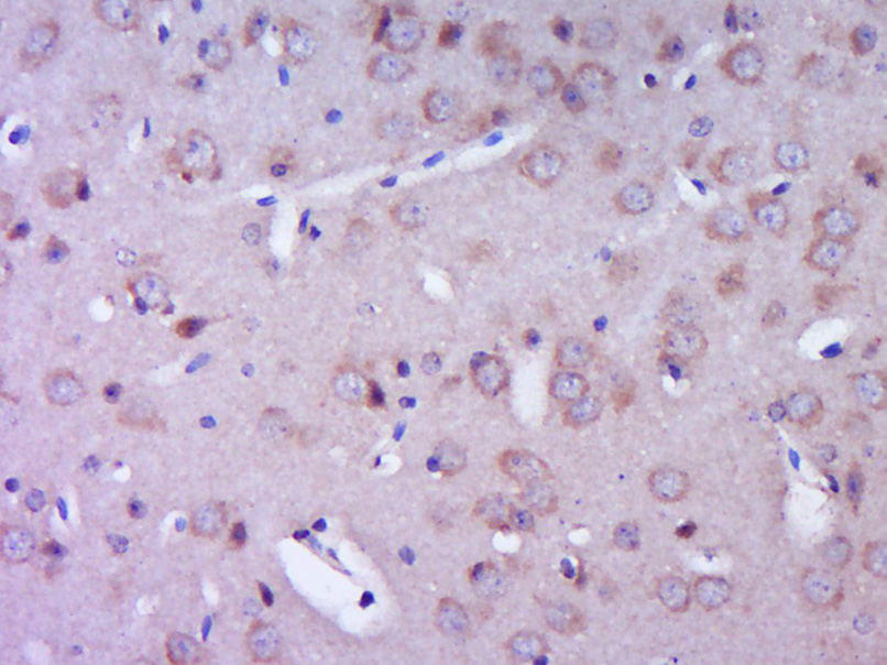 RIP2 Rabbit pAb(bs-3546R)-50ul