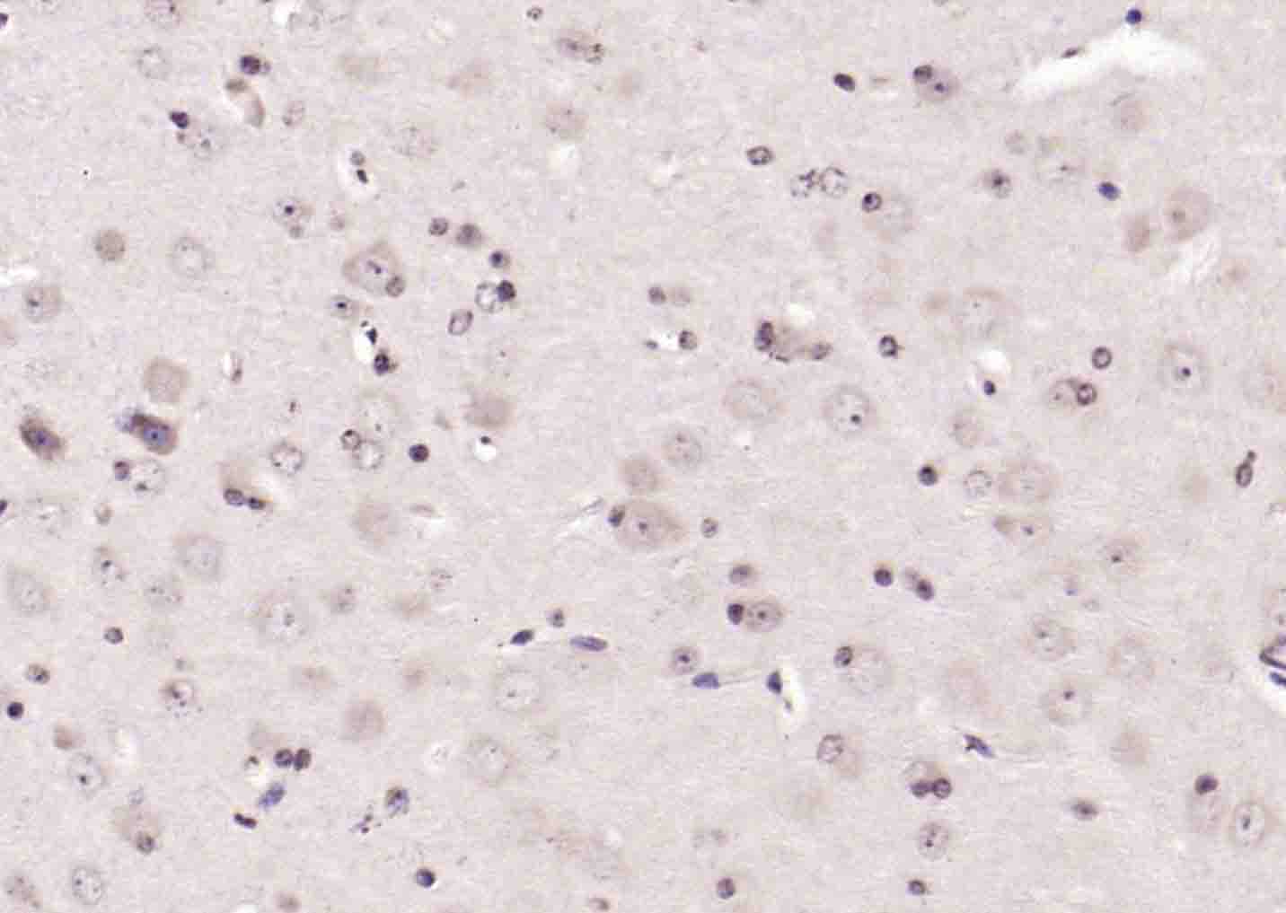 phospho-c-ABL (Tyr245) Rabbit 