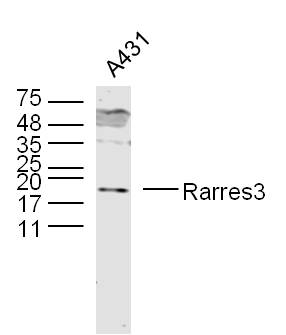 Rarres3 Rabbit pAb(bs-1917R)-5