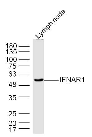 IFNAR1 Rabbit pAb(bs-4116R)-50