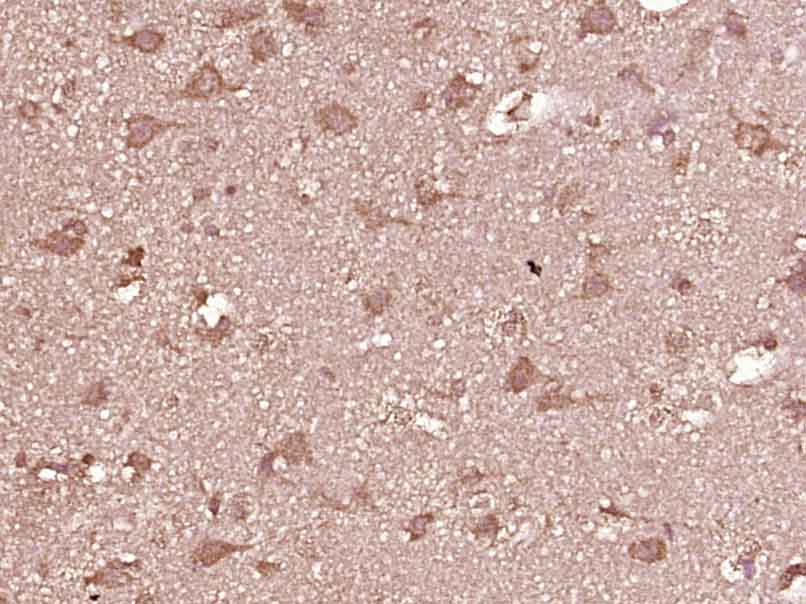 MMP12 Rabbit pAb(bs-1854R)-50u