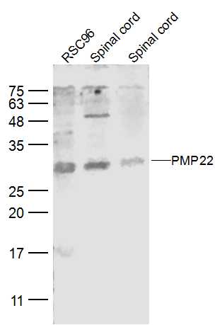 PMP22 Rabbit pAb(bs-0235R)-50u