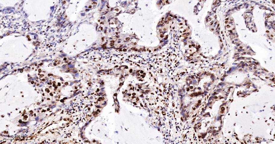 Ku80 Recombinant Rabbit mAb(bs