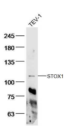 STOX1 Rabbit pAb(bs-12805R)-50