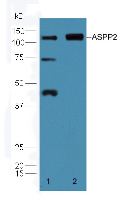 ASPP2 Rabbit pAb(bs-1283R)-50u