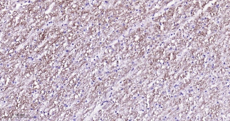 ADAM10 Recombinant Mouse mAb(b