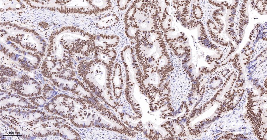 Ku80 Recombinant Rabbit mAb(bs