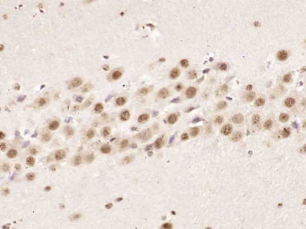 hnRNP K Rabbit pAb(bs-4296R)-5