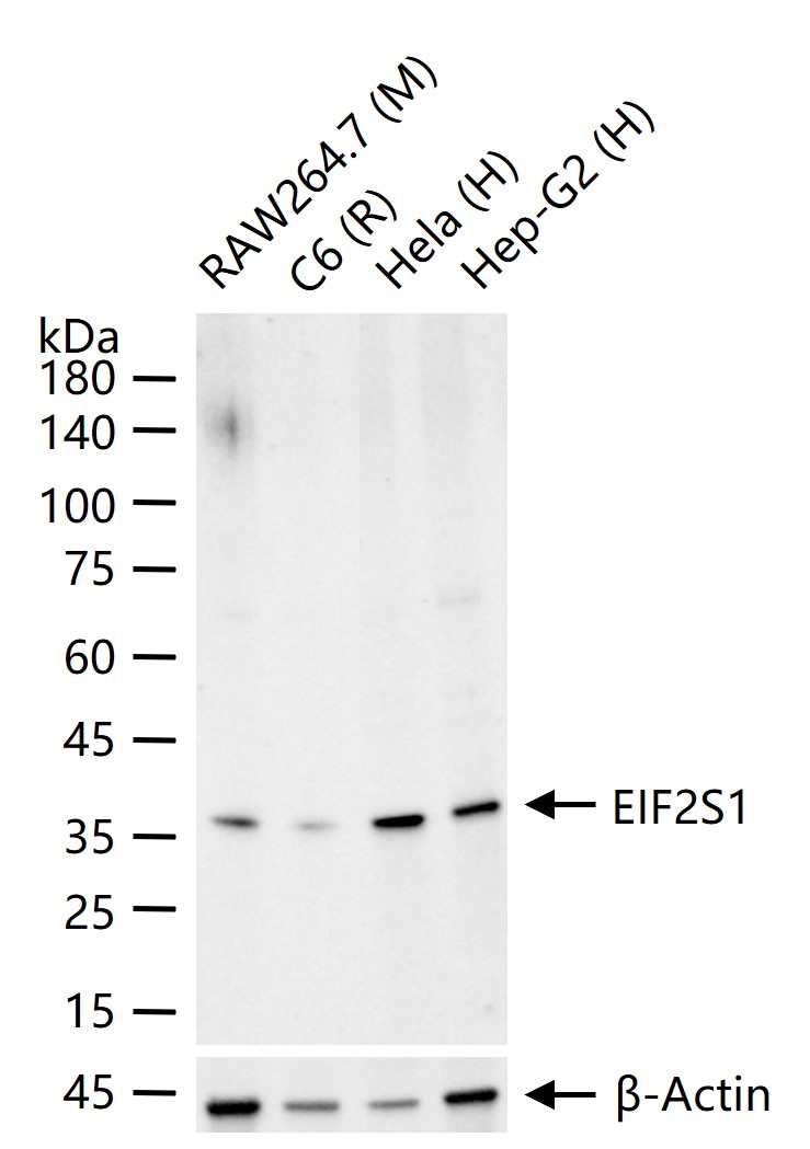 EIF2S1 Recombinant Rabbit mAb(