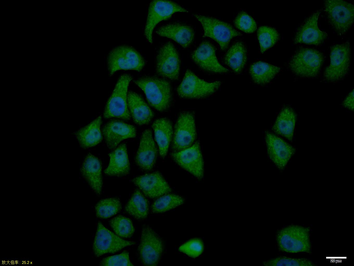 phospho-Cyclin B1 (Ser126) Rab