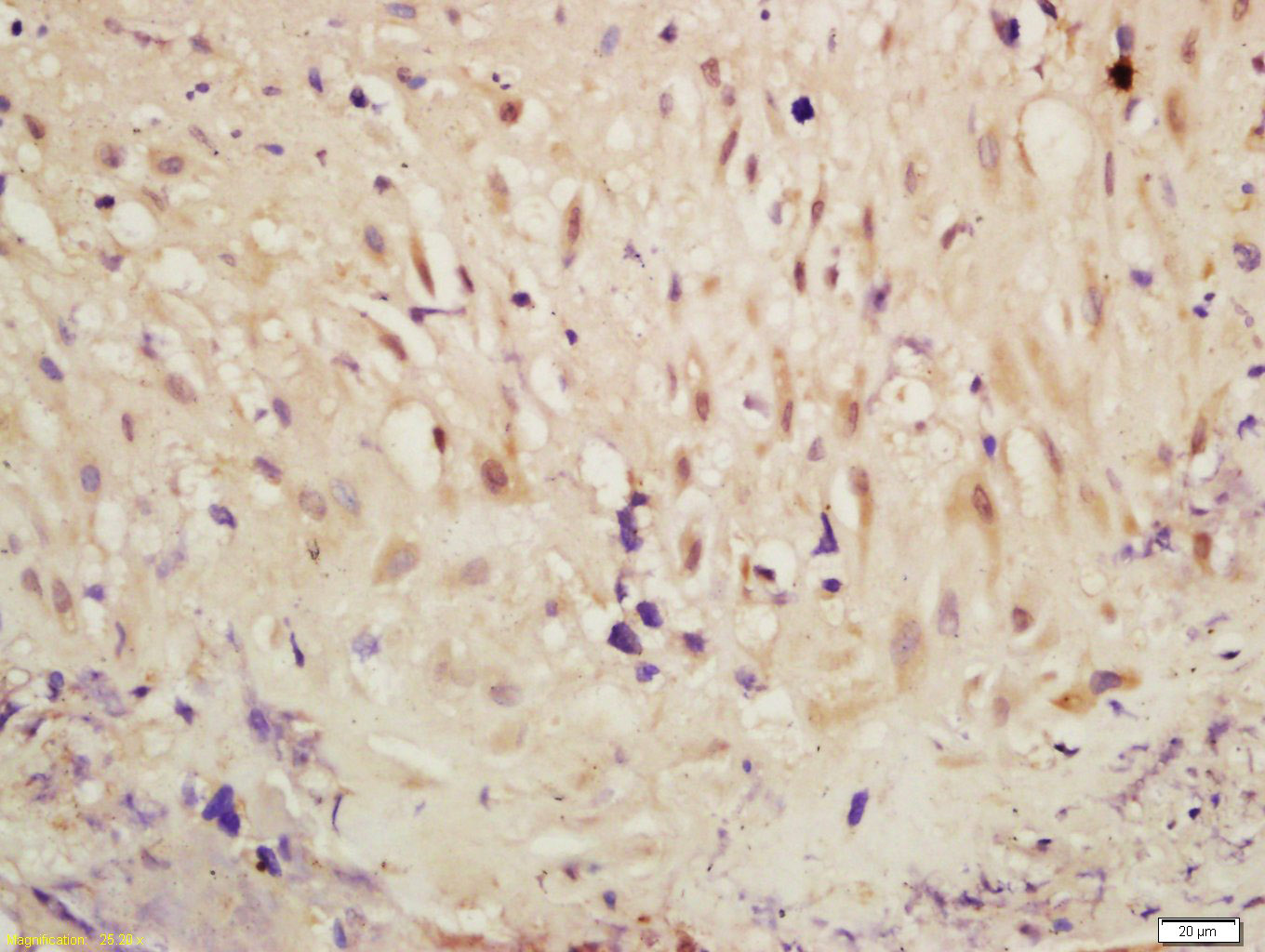 phospho-RSK2 (Ser227) Rabbit p