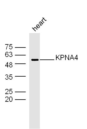 KPNA4 Rabbit pAb(bs-16804R)-50