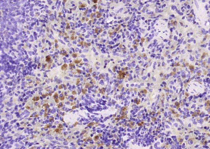 MD1 Rabbit pAb(bs-2661R)-50ul/