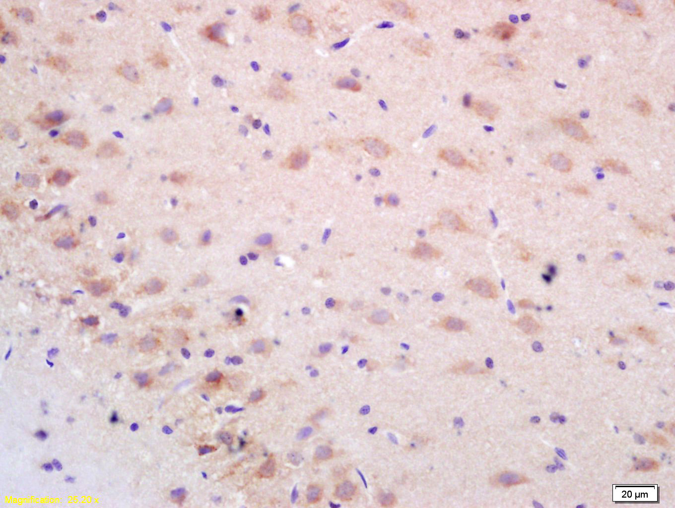 NALP2 Rabbit pAb(bs-6717R)-50u